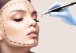 rhinoplasty-turkey