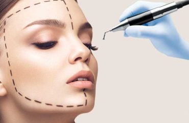 rhinoplasty-turkey